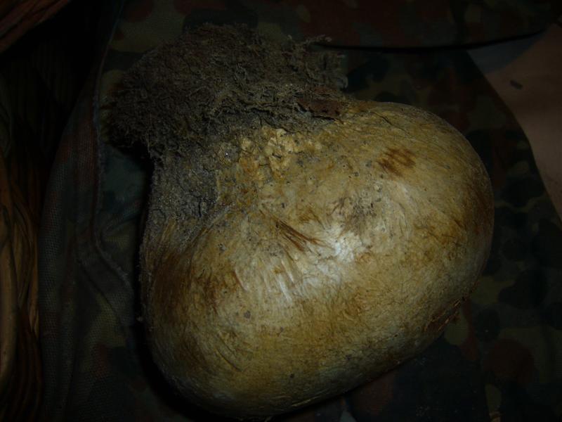 Scleroderma ?
